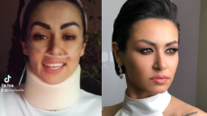 Μαρία Τζινέρη: Σοκάρει η περιγραφή της για το τροχαίο που είχε - Νοσηλεύεται στο ΚΑΤ