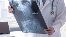 Λιθουανία: Ένα κιλό βίδες και καρφιά στο στομάχι ενός ασθενούς - Δείτε φωτογραφία 