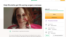 Βρετανία: 36χρονη με σπάνιο σύνδρομο στομάχου ζυγίζει κάτω από 20 κιλά - Διαγνώστηκε λανθασμένα με νευρική ανορεξία