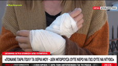 Γλυκά Νερά: Γυναίκα δέχθηκε άγρια επίθεση από πίτμπουλ στη μέση του δρόμου - «Τα χέρια μου αχρηστεύτηκαν»