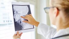 Αφαίρεση φρονιμίτη και άλλοι 4 σοβαροί λόγοι που χρειαζόμαστε γναθοχειρουργό