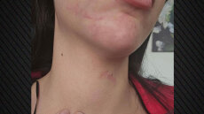 Έδεσσα: Στο εδώλιο του δικαστηρίου ο 34χρονος που κατηγορείται ότι ξυλοκόπησε τη σύντροφό του