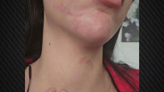 «Με βιντεοσκόπησε για να μου υπενθυμίζει τι θα παθαίνω άμα δεν τον ακούω», λέει η 29χρονη που ξυλοκοπήθηκε στην Έδεσσα