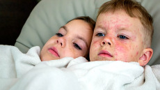 Τι θα συμβεί όταν ένα παιδί με ιλαρά πηγαίνει σχολείο – Το βίντεο του ΠΟΥ απαντά