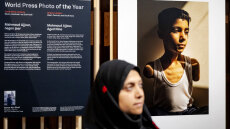 World Press Photo: Πρώτο βραβείο στη φωτογραφία ενός 9χρονου Παλαιστίνιου ακρωτηριασμένου και από τα δύο χέρια