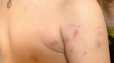 Επίθεση αδέσποτου σκύλου σε ανήλικο στο Αιτωλικό - Μεταφέρθηκε στο νοσοκομείο με σοβαρά τραύματα