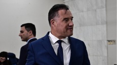 Ο Άδωνις Γεωργιάδης παραδέχθηκε τη μεταμόσχευση μαλλιών: Οι άντρες πρέπει να βελτιώνονται αν και εφόσον είναι εφικτό