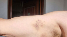 H ιατροδικαστική έκθεση για τον επιχειρηματία στη Μύκονο επιβεβαιώνει τραυματισμούς και υπογλυκαιμία - ΕΔΕ για τους αστυνομικούς 