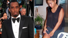 Οι φωτογραφίες που αποτύπωσαν τα τραύματα της Κάσι Βεντούρα από τους ξυλοδαρμούς του Diddy: Μελανιές στο σώμα και ένα κομμένο φρύδι