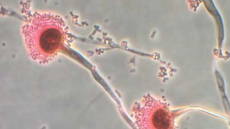 CNN: Αγωνία στους επιστήμονες για φονικούς μύκητες που μπορούν να «μας φάνε από μέσα προς τα έξω»
