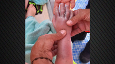 Στιγμές τρόμου σε ξενοδοχείο στη Μαγιόρκα: Σωλήνας ρούφηξε το χέρι 4χρονου - Δείτε φωτογραφίες