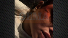 Καταδικάστηκε 25χρονος για τον άγριο ξυλοδαρμό γνωστού μοντέλου - «Ζούσε σε καθεστώς τρόμου»