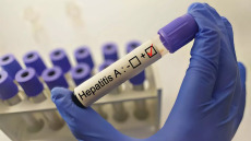 Ηπατίτιδα Α: Σημαντική αύξηση κρουσμάτων σε 4 ευρωπαϊκές χώρες – Η θέση της Ελλάδας
