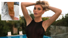 «Πίστεψα ότι θα πεθάνω»: Influencer δείχνει τα τραύματά της μετά την αθώωση του πρώην της για άγρια επίθεση