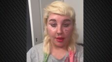 Η Αμάντα Μπάινς ανακοίνωσε ότι θα κάνει χρήση Ozempic  - Ζυγίζει 173 κιλά και ελπίζει να φτάσει στα 130