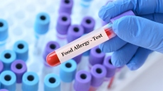 Το 30% του πληθυσμού παγκοσμίως πάσχει από κάποιου είδους αλλεργία
