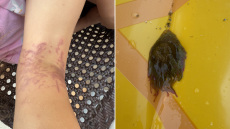 Περιπέτεια για 6χρονη στην Κέα: Την τσίμπησε θαλάσσια ανεμώνη, γύρισε εσπευσμένα στην Αθήνα για νοσηλεία - Δείτε φωτογραφίες