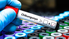 «Καμπανάκι» ΠΟΥ για τον ιό Τσικουνγκούνια – Πού καταγράφονται κρούσματα στην Ευρώπη