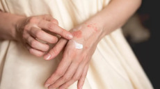 Χρόνιο έκζεμα: «Πράσινο φως» από τον FDA για την πρώτη θεραπευτική κρέμα χεριών
