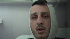 Μου δάγκωσε το αυτί, φώναζε «είμαι Χαμάς», λέει ο Ισραηλινός για τη συμπλοκή με Σύρο σε beach bar στον Άλιμο