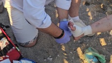 Θαλάσσια χελώνα επιτέθηκε σε λουόμενη σε παραλία της Αναβύσσου - Την τραυμάτισε σοβαρά στο πόδι