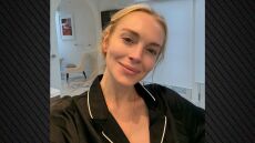 Η Λίντσεϊ Λόχαν πόζαρε χωρίς μακιγιάζ μετά την άρνηση πλαστικών επεμβάσεων: «Ποιο είναι το μυστικό σου;» της γράφουν