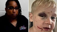 Άγριος ξυλοδαρμός μωρού ενός έτους σε παιδικό σταθμό στις ΗΠΑ – Αντιδράσεις για την αποφυλάκιση της κατηγορούμενης