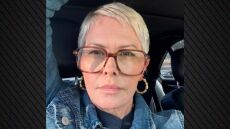 Νικόλ Έγκερτ μετά τη δεύτερη μαστεκτομή: Το να κοιτάς τον θάνατο κατά πρόσωπο είναι πολύ δύσκολο