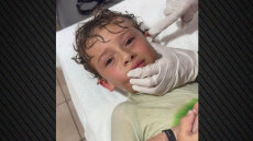 Καβούρι μπήκε στο αυτί παιδιού στο Μεξικό, βίντεο από τη στιγμή που οι γιατροί το βγάζουν ζωντανό