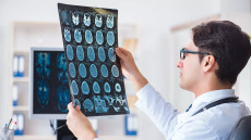 Νέα εποχή στη μάχη κατά της νόσου Αλτσχάιμερ – Τι ζητούν οι επιστήμονες