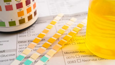 Πρωινά ούρα: Τι αποκαλύπτει το χρώμα τους για την υγεία και την ψυχική μας διάθεση
