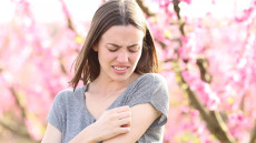 Κινδυνεύει η ζωή μας από τσιμπήματα εντόμων; Μία αλλεργιολόγος απαντά
