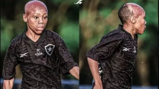 Από τα εγκαύματα στο γρασίδι του γηπέδου: Η συγκλονιστική ιστορία του 11χρονου Μπερνάντο
