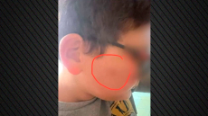 Δεν μπορώ να τον φέρω σε αυτό το σχολείο: Συγκλονίζει η μητέρα του 11χρονου που ξυλοκοπήθηκε στο διάλειμμα από συμμαθητές του