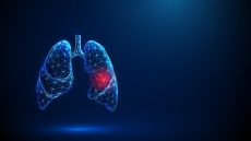 Νέα εποχή στη θεραπεία του καρκίνου του πνεύμονα με τεχνική που υπόσχεται λιγότερες παρενέργειες
