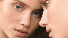 Η γενιά του baby botox: Πώς το marketing απογείωσε τις ενέσιμες θεραπείες ομορφιάς και τα fillers έγιναν η νέα... κανονικότητα στην Ελλάδα