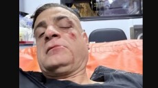 Άγριος ξυλοδαρμός Youtuber στο μετρό της Ρώμης - Του επιτέθηκαν οι πορτοφολάδες που βιντεοσκοπούσε, δείτε βίντεο