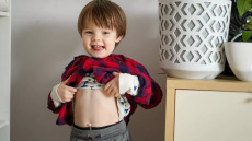 Ομφαλοκήλη: Πότε είναι επικίνδυνη και πώς αντιμετωπίζεται – Τι ισχύει για ενήλικες και βρέφη
