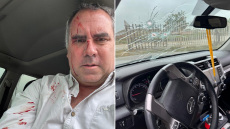 Επίθεση με πυρά από αγνώστους δέχτηκε ο υποψήφιος της Δεξιάς στις προεδρικές εκλογές του Περού