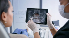 Προσοχή σε παραπλανητικές διαφημίσεις για «άμεσα και γρήγορα εμφυτεύματα» – SOS από οδοντιάτρους
