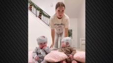 Οργή στις ΗΠΑ με influencer που φορά κράνη για 23 ώρες την ημέρα στα μωρά της για να αλλάξει το σχήμα του κεφαλιού τους