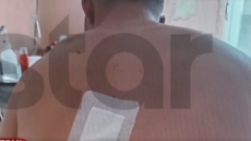 Τροχαίο με εγκατάλειψη στο Πικέρμι: «Πονάω αφόρητα, παραμορφώθηκα» λέει ο 22χρονος Άγγελος 