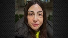 Η Ιωάννα Παλιοσπύρου ανέβασε εικόνες και βίντεο από την αποκατάσταση μετά την επίθεση με βιτριόλι