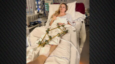 «Μπορεί να ακρωτηριαστεί το πόδι της» λέει ορθοπεδικός για τη Λίντσεϊ Βον που τραυματίστηκε σοβαρά στους Χειμερινούς Ολυμπιακούς