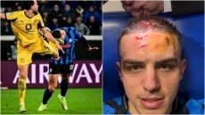 Αταλάντα: Η σοκαριστική φωτογραφία του Κρστόβιτς από την κλωτσιά του Μπενσεμπαϊνί
