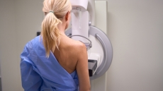 Σημαντική αύξηση στα κρούσματα καρκίνου του μαστού ετησίως ως το 2050 προβλέπει παγκόσμια έρευνα