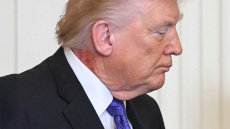 Εξάνθημα στον λαιμό του Τραμπ προκαλεί νέα ερωτήματα για την υγεία του, δείτε βίντεο