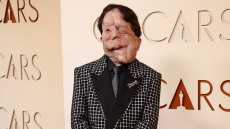 Η εμφάνιση του Άνταμ Πίρσον που πάσχει από νευροϊνωμάτωση στα φετινά Όσκαρ