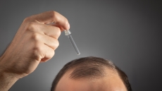 Τέλος η φαλάκρα; Νέος φυτικός ορός από την Κίνα συνδέεται με επανεμφάνιση μαλλιών μέσα σε λίγες εβδομάδες
