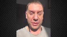 Γιώργος Μαζωνάκης: Μην ξανακούσω κανέναν να λέει ότι δεν θα γίνει η συναυλία μου λόγω του ματιού μου, θα του κόψω το κεφάλι 